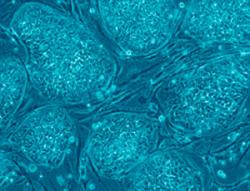 stem_cells